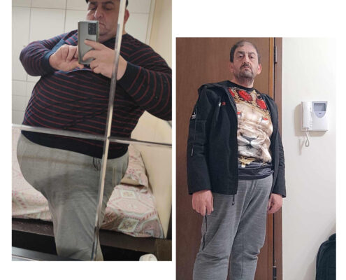 Γαστρικο Μανικι
