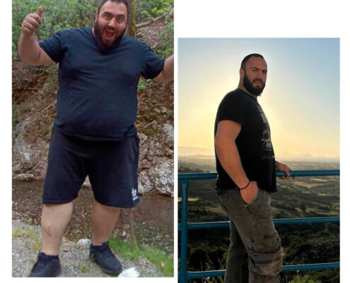 Γαστρικο Μανικι