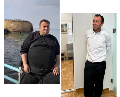 ΓΑΣΤΡΙΚΟ ΜΑΝΙΚΙ