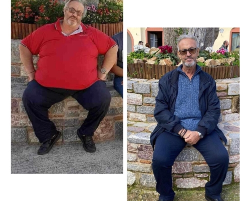 ΓΑΣΤΡΙΚΟ ΜΑΝΙΚΙ