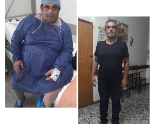 ΓΑΣΤΡΙΚΟ ΜΑΝΙΚΙ