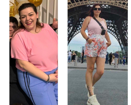 ΓΑΣΤΡΙΚΟ ΜΑΝΙΚΙ