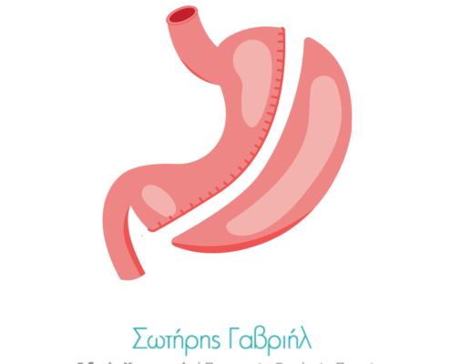 Παχυσαρρκία