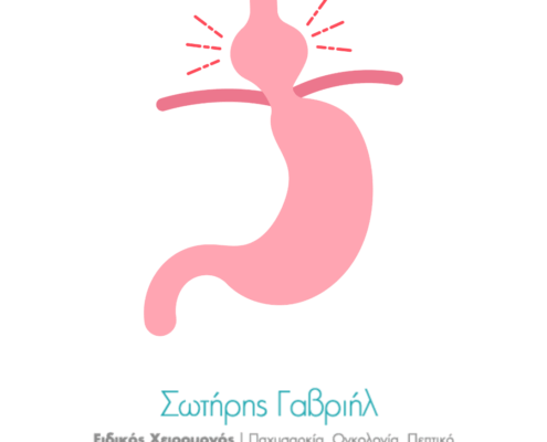 Διαφραγματοκηλη