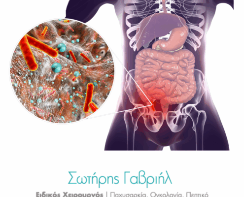 ΣΚΩΛΗΚΟΕΙΔΙΤΙΔΑ