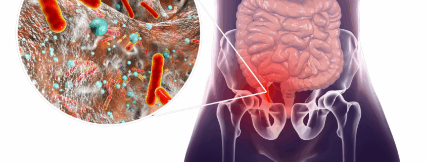 ΣΚΩΛΗΚΟΕΙΔΙΤΙΔΑ