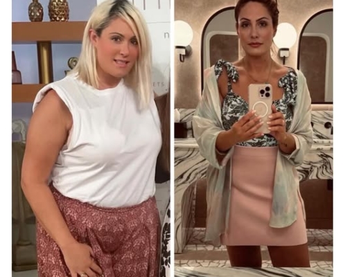 ΓΑΣΤΡΙΚΟ-ΜΠΟΤΟΞ-BOTOX- ΠΑΧΥΣΑΡΚΙΑ