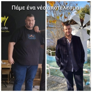 ΓΑΣΤΡΙΚΟ-ΜΑΝΙΚΙ-SLEEVE