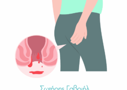 αιμορροΐδες είδη