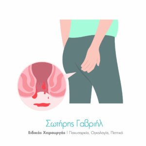αιμορροΐδες είδη