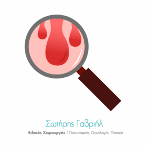 αιμορροΐδες και αγχος