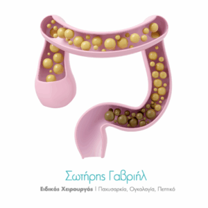 αιμορροΐδες-και-δυσκοιλιοτητα