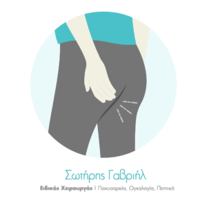 πως γινεται η διαγνωση των αιμορροιδων