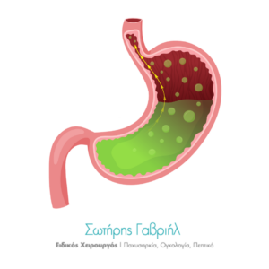 διαφραγματοκήλη-φάρμακα.