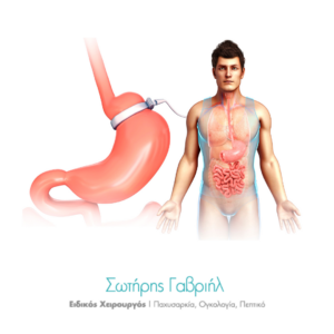Αφαίρεση Γαστρικού Δακτυλίου και Γαστρικό Μανίκι