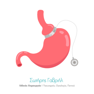 Αφαίρεση Γαστρικού Δακτυλίου και Γαστρικό Μανίκι