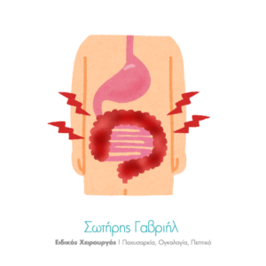 Σπαστική Κολίτιδα