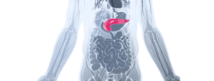 παγκρεατεκτομή χειρουργείο στο πάγκρεας