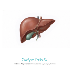 καρκίνος χοληδόχου κύστης