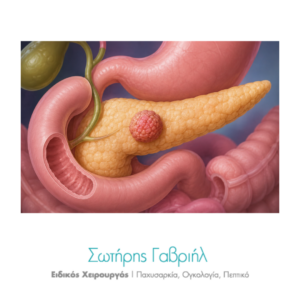 somatostatinoma