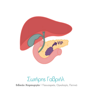 Vipoma