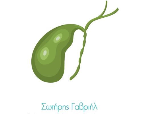 πολύποδες χολής